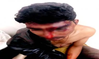 बालोद में तीन युवकों की बेरहमी से पिटाई: बेल्ट-डंडों से हमला, शुद्धीकरण के नाम पर पेशाब किया