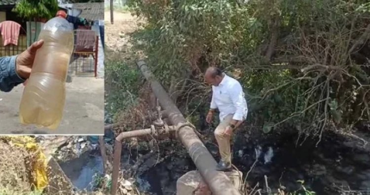 CG NEWS: भिलाई में पीलिया का प्रकोप, गंदे पानी से 35 से ज्यादा बच्चे बीमार